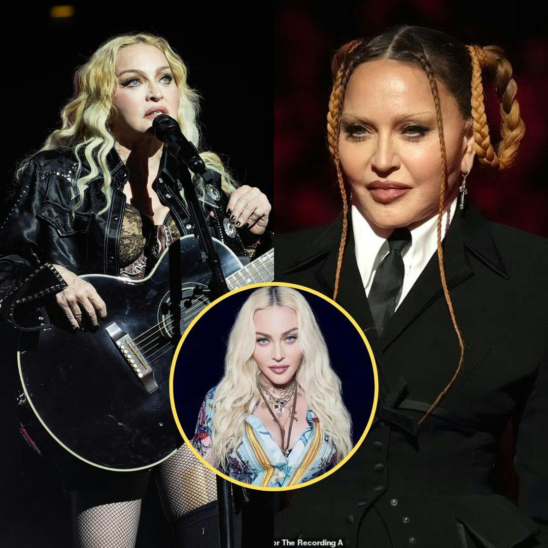Cover Image for EXCLUSIVE: Material girl? Plastic surgeons weigh in on what they REALLY think happened to Madonna’s face after ‘unrecognizable’ Grammys appearance – from ‘excessive filler and Botox’ to a facelift and nose job